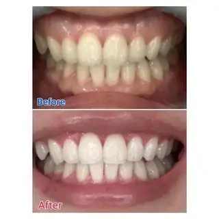 M渋谷店所属・M渋谷 ホワイトニングのエステ・リラクイメージ