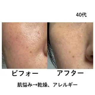 CHEERFUL-チェアフル-所属・CHEERFUL- チェアフル-山本直子のエステ・リラクイメージ