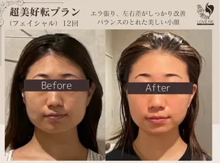 総合美容サロン LOVEME渋谷本店のエステ・リラクイメージ