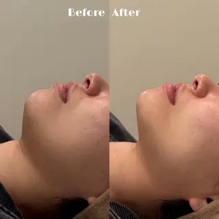 # fu♡のエステ・リラクイメージ