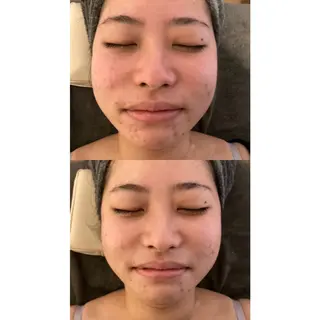 美時雨・bishigure所属・美時雨 bishigureのエステ・リラクイメージ