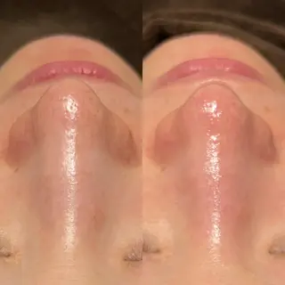 眉毛×肌質改善🫧 高岳/新栄町✨YUUの眉毛・アイブロウイメージ