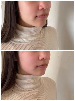 痛くない垢抜け小顔& 姿勢⭐︎AQUA-Bのエステ・リラクイメージ