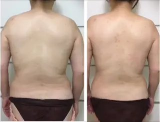 ヤマダ アキナのエステ・リラクイメージ