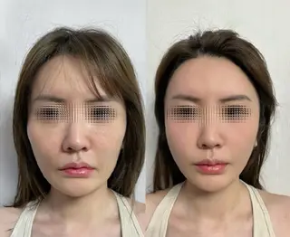 aliaハイフ&水光ジェットサロン所属・aliaハーブ水光店 エステティシャン募集のエステ・リラクイメージ