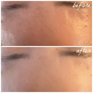 メンズ メナード岐阜市茜部 杉浦のエステ・リラクイメージ