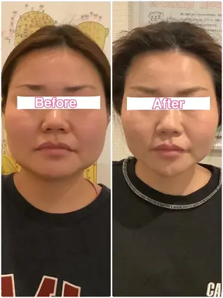 美容鍼・整体サロン アネモネ🌸心斎橋のエステ・リラクイメージ