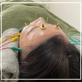 美容鍼灸サロン   colorier所属・美容鍼灸サロン colorierのエステ・リラクイメージ