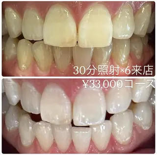 PLATINUM Beauty 横浜店所属・ホワイトニングルーム 横浜店のその他イメージ