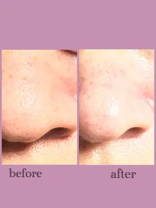 脱毛サロンPetit ange所属・Petit ange 綾瀬のエステ・リラクイメージ