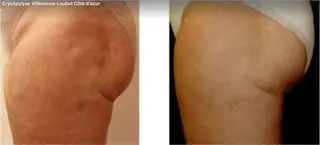 ANRIRE (アンリール)のエステ・リラクイメージ