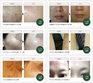 total beauty salon RIRE所属・古川 弥生のエステ・リラクイメージ