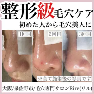 隅田 都布子のマツエク・マツパデザイン