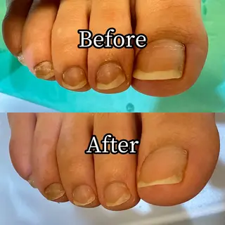 ネイル 巻き爪補正店 横浜関内店のネイルデザイン