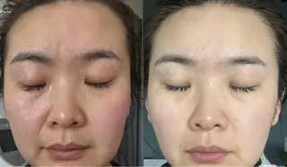 カラー aliaハイフ&水光ジェットサロン所属・aliaハーブ水光店 エステティシャン募集のエステ・リラクイメージ