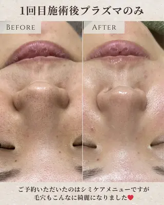 シミ毛穴|眉Wax THE flowのエステ・リラクイメージ