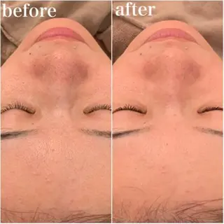 ニキビ/美肌 メゾンリュバンのエステ・リラクイメージ