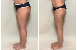 salon lady_goのエステ・リラクイメージ