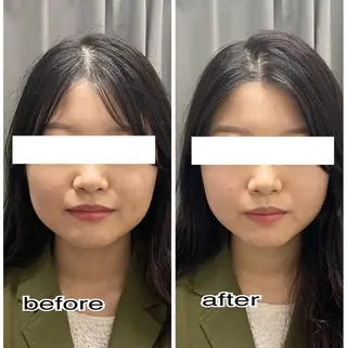 ENCHANT 脱毛.小顔.毛穴のエステ・リラクイメージ