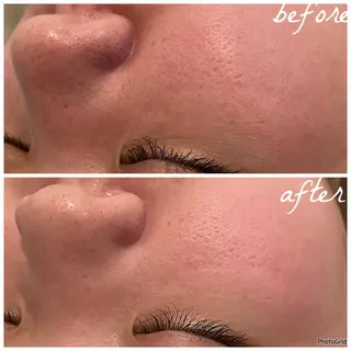 メンズ メナード岐阜市茜部 杉浦のエステ・リラクイメージ