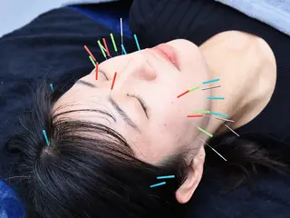 美容鍼・小顔矯正 FLOW 鍼灸整体院のその他イメージ