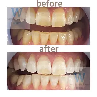 ホワイトニング ショップ船橋2号店のエステ・リラクイメージ