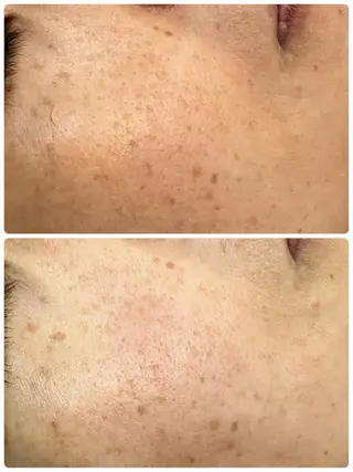 温活美肌専門サロン Lien『リアン』のエステ・リラクイメージ