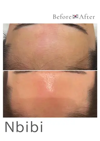 韓国🇰🇷価格 サロン_Nbibiのエステ・リラクイメージ