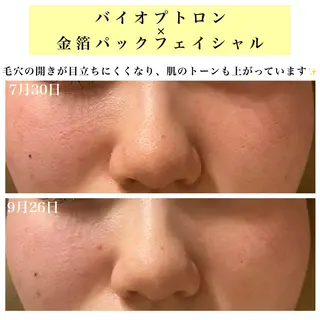 Bellesthe （ベルエステ）のエステ・リラクイメージ