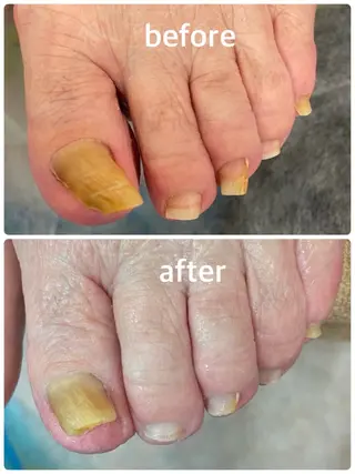 ネイル 足・爪トラブル専門店　foot grace所属・加藤 望のネイルデザイン