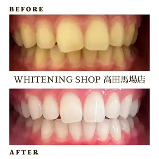 メンズ ホワイトニング ショップ高田馬場店のその他イメージ