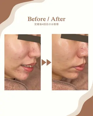 ＆epi 【エステ】のエステ・リラクイメージ