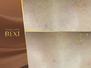 メンズ ビューティーサロンベクスト beautysalonBEXT所属・ビューティーサロン ベクスト名古屋のエステ・リラクイメージ