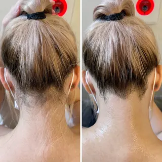 うなじ脱毛/美肌脱毛 LABELのエステ・リラクイメージ