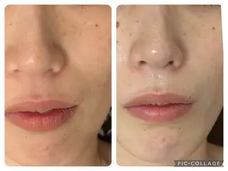 Silky ✖︎ Snow White｜エイジングケア＆美肌脱毛専門サロン所属・O 朋美のエステ・リラクイメージ