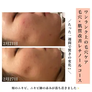 Bellesthe (ベルエステ)のエステ・リラクイメージ