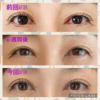 マツエク・マツパ Matricaria AKIのマツエク・マツパデザイン