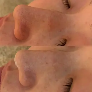 デアイム東広島所属・中井 小春のエステ・リラクイメージ