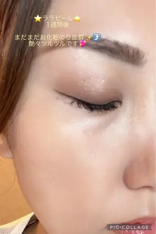 y.laBelle所属・y.laBelle 艶肌・小顔・肌質改善のエステ・リラクイメージ