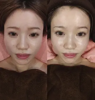 ソリーシェ鍼灸院 上野・稲荷町のエステ・リラクイメージ