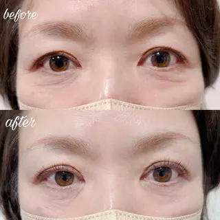 マツエク・マツパ merveilles所属・まつげ/整体/にきび ・アトピー専門サロンのマツエク・マツパデザイン