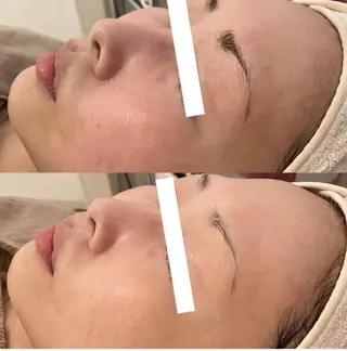 ララ/ハーブ メゾンリュバンのエステ・リラクイメージ