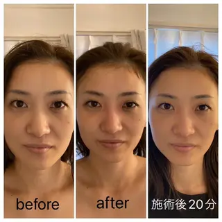 喜山 あつこのエステ・リラクイメージ