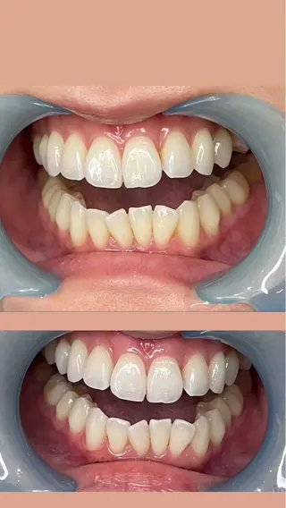 LAVISH nail salonのネイルデザイン