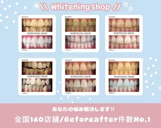 ホワイトニングショップ静岡葵区店所属・ホワイトニング ショップ葵区静岡駅店のその他イメージ