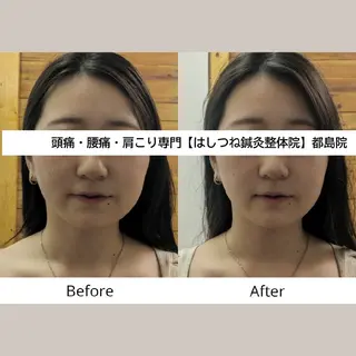 頭痛・腰痛・肩こり 特化してます。 橋岡のエステ・リラクイメージ