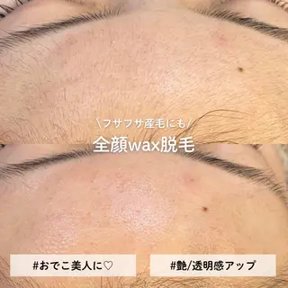 EST BEAUTY所属・顔ワックス脱毛/ ハーブピーリングのエステ・リラクイメージ