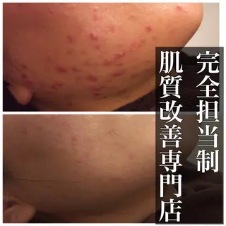 ミディアム カラー パーマ ヘアアレンジ メンズ キッズ ネイル マツエク・マツパ ニキビ・肌質改善専門 ♡人生が変わるサロンのエステ・リラクイメージ