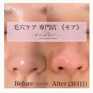 Eyelash salon MORE(モア)所属・安納 麻穂のエステ・リラクイメージ