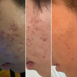 癒しのサロン FUWARIのエステ・リラクイメージ